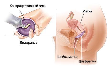 Диафрагма