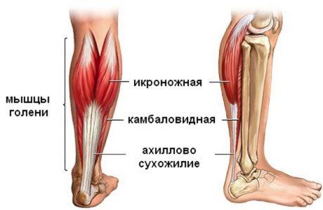 Ахилловы сухожилия