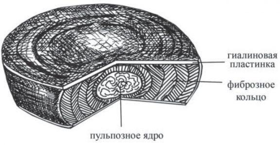 Схема строения межпозвонкового диска