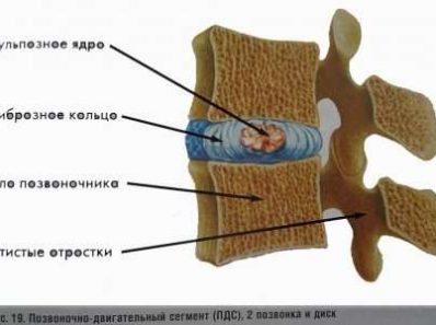 Позвоночно-двигательный сегмент (ПДС)