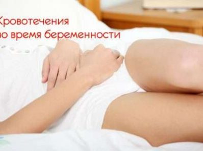 Кровотечения во время беременности и в родах