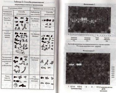 Забытое представление о трихомонадах - паразитах крови