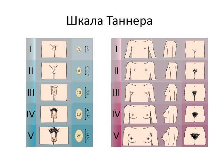 Вся правда о детских силовых тренировках 3 Шкала Таннера