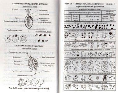 Забытое представление о трихомонадах - паразитах крови