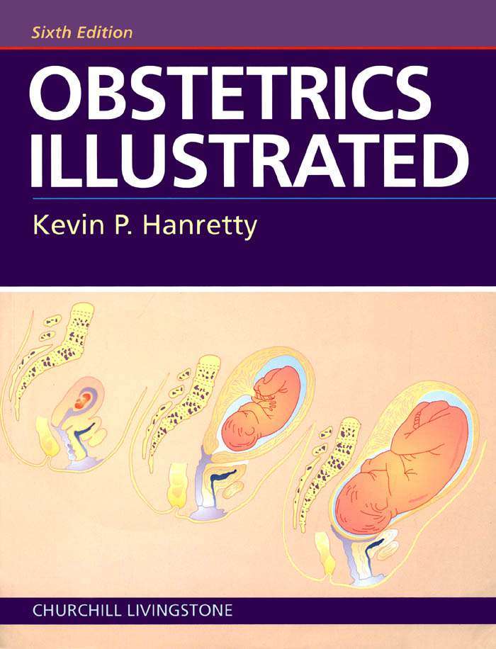 Иллюстрированное Акушерство. Оригинальное издание (OBSTETRICS ILLUSTRATED) 13 Иллюстрированное Акушерство. Оригинальное Издание
