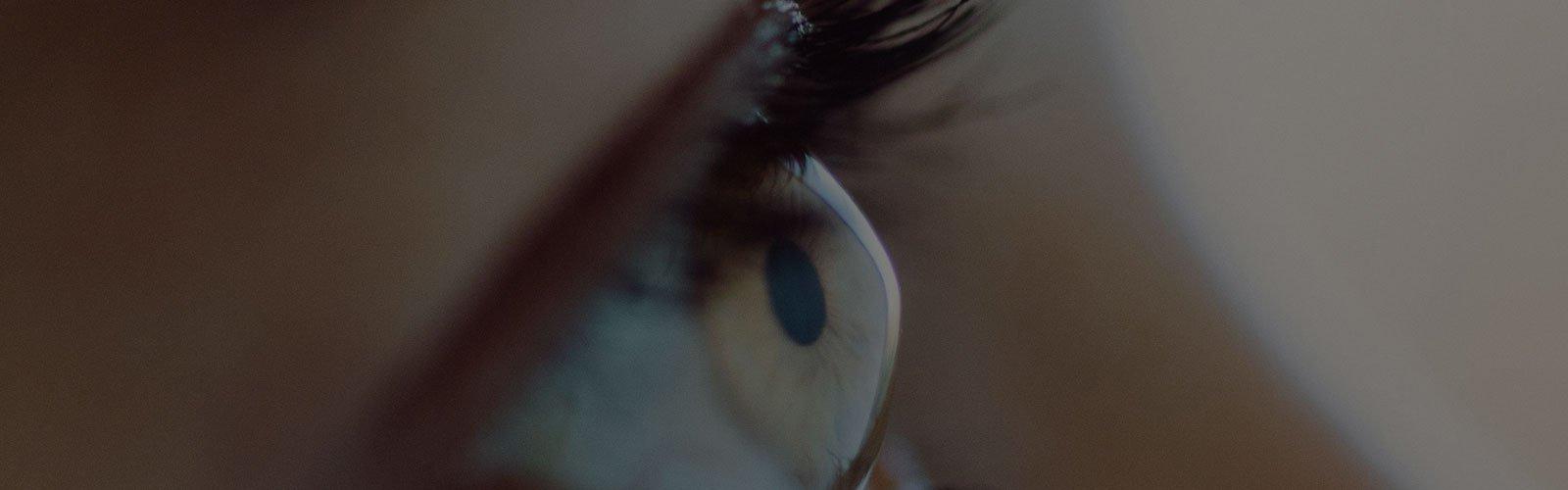 Как я победила кератоконус 7 c3r for keratoconus