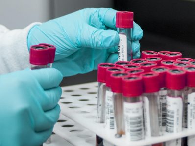 Исследователи предупреждают, что некоторые вакцины против COVID-19 могут увеличить риск заражения ВИЧ