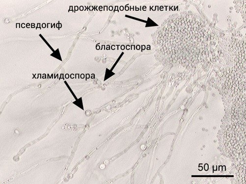 Candida albicans risunok1