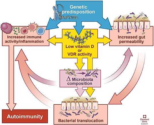 Как здоровье кишечника влияет на ваше здоровье 9 Vitamin D Deficiency May Contribute To Autoimmune Disease
